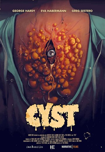 Киста || Cyst (2020)