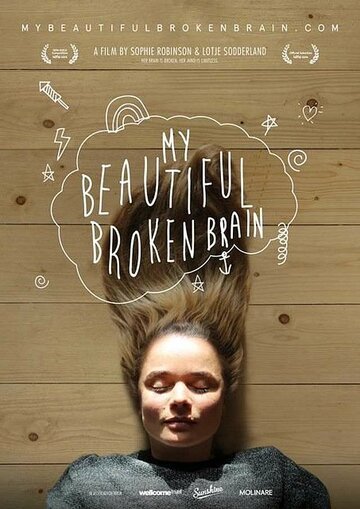 Мой прекрасный сломанный мозг || My Beautiful Broken Brain (2014)