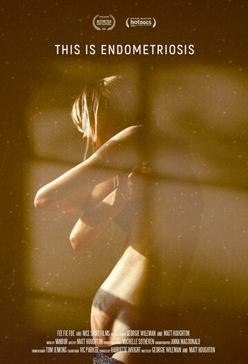 Постер фильма Это эндометриоз
